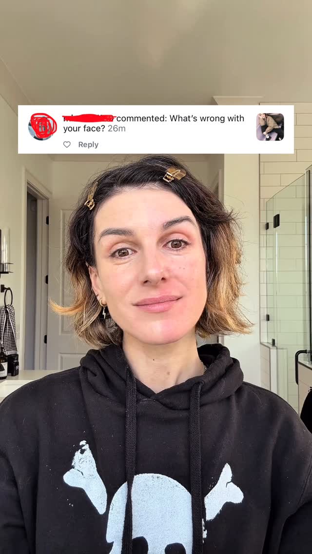 For everyone who’s ever been asked “What’s wrong with your face?” or “Did you get too much sun?” because your face just decided to flush…This one is for us.I’ve spent most of my life navigating rosacea—the sudden flare-ups, the layers of heavy foundation just to feel “normal,” and the constant unsolicited comments and advice.Now, I’m developing a solution I’ve always wanted: a non-makeup, skincare-first solution designed specifically to camouflage and calm redness without the cakey finish of foundation — slowly, intentionally, and alongside a community that actually gets it.Want to be the first to try the samples of what I’m working on and ride with me alongside a community of fellow red-faced queens? COMMENT ‘RED’ and I’ll slide into your DMs with the waitlist link!It’s early days, and I’m so glad you’re here for the start of it. ❤️ by @shenaegrimesbeech