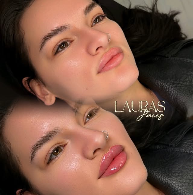 ✨✨✨ by @laurasfaces1