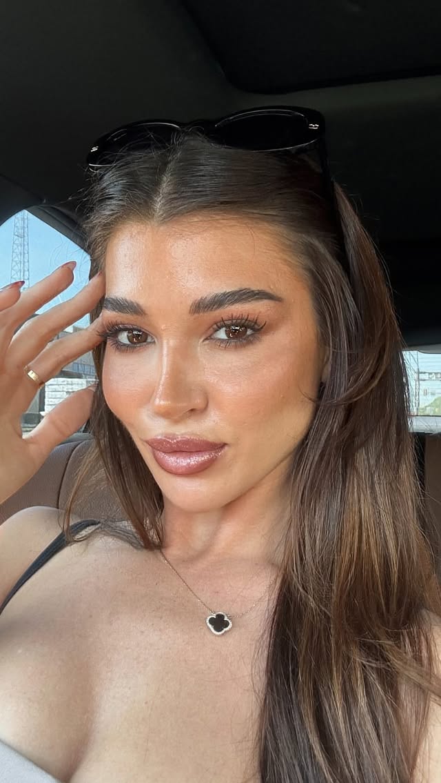 Trust the process or something 🤭 #lipfillers #lipfillerjourney #hafiller #liptransformation #forthegirls by @alie.lima