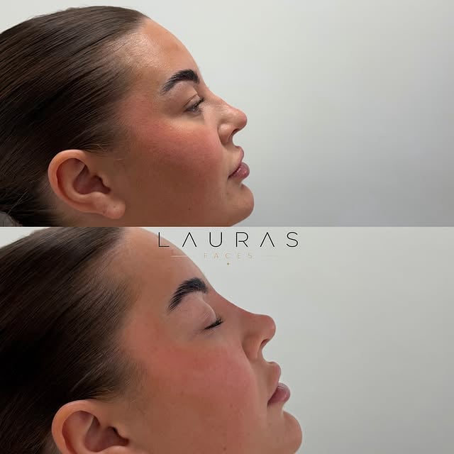 Guess the change. ✨🤍 by @laurasfaces1